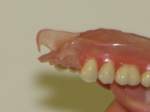 Valplast fogsorok