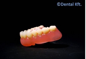 Valplast dentures